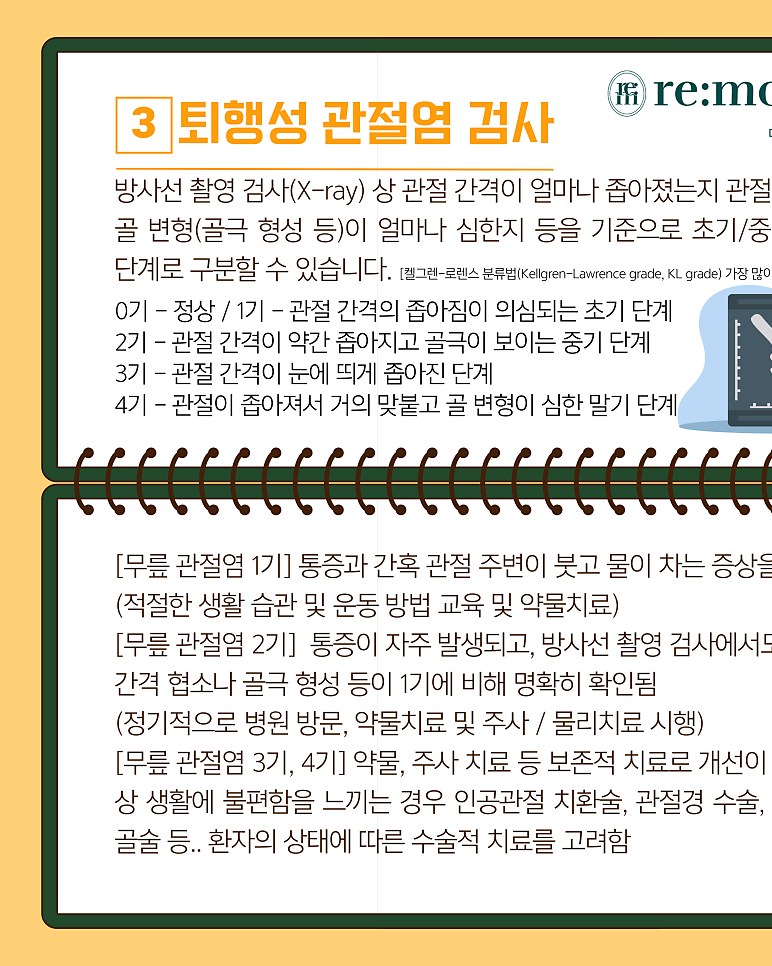 퇴행성 관절염 단계별 증상과 운동 관리법 총정리