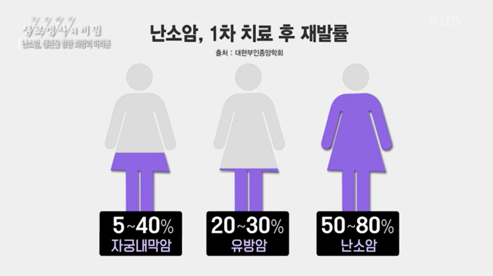 난소암 예방과 관리: 조기 발견 어려운 여성암 대응 가이드